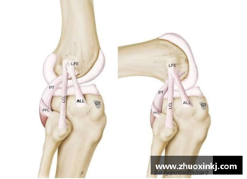 球员跟腱受伤：预防与康复策略全面解析